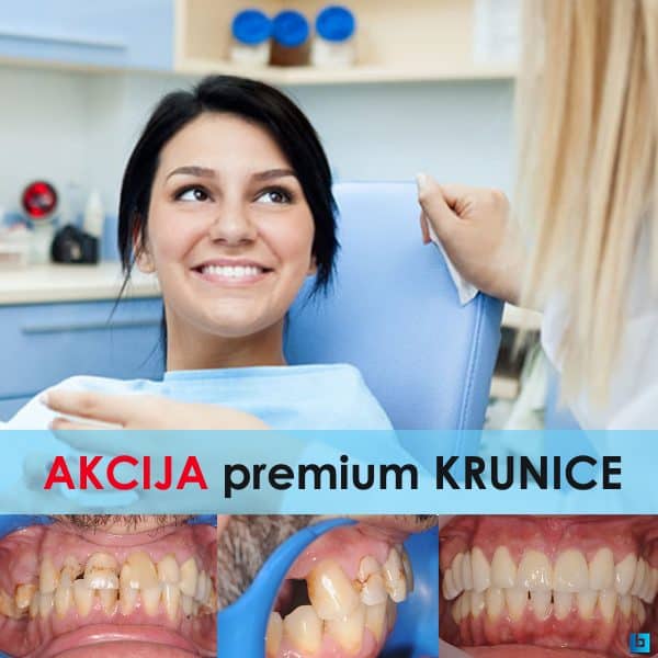 estetska-stomatologija-oralno-zdravlje-zubi-estetska-stomatologija-karijes-oralna-higijena-zubi-stomatološka-poliklinika-breyer