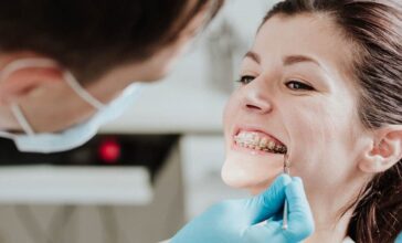 kieferorthopaedie-aparatić-za-zube-ortodoncija-savjeti-dentalna-poliklinika-breyer.